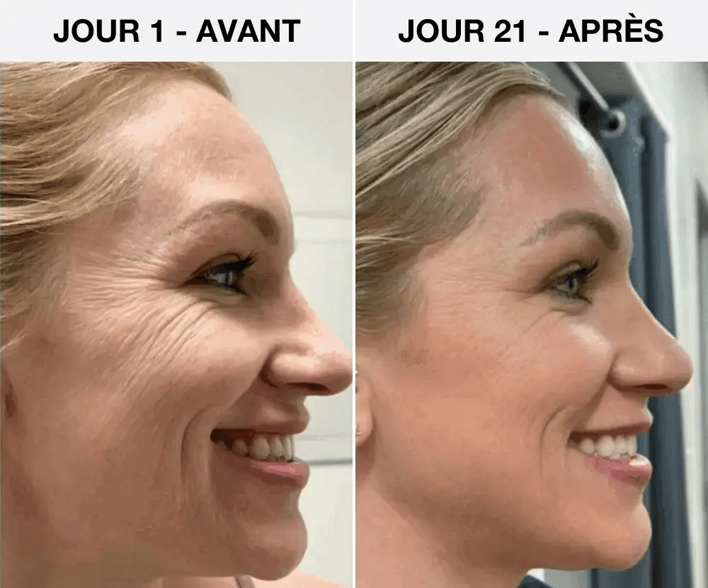 NEXUS LED 7-en-1 Sculpteur Facial - Nexus