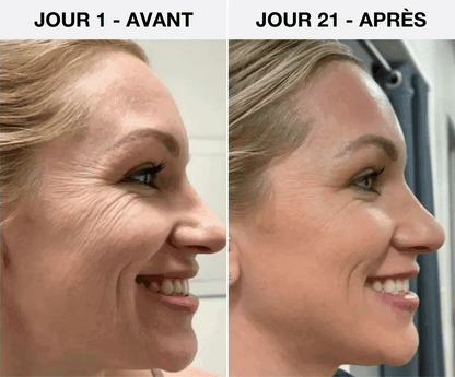 NEXUS LED 7-en-1 Sculpteur Facial - Nexus